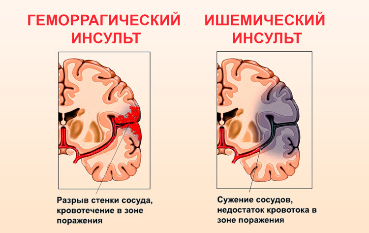 виды